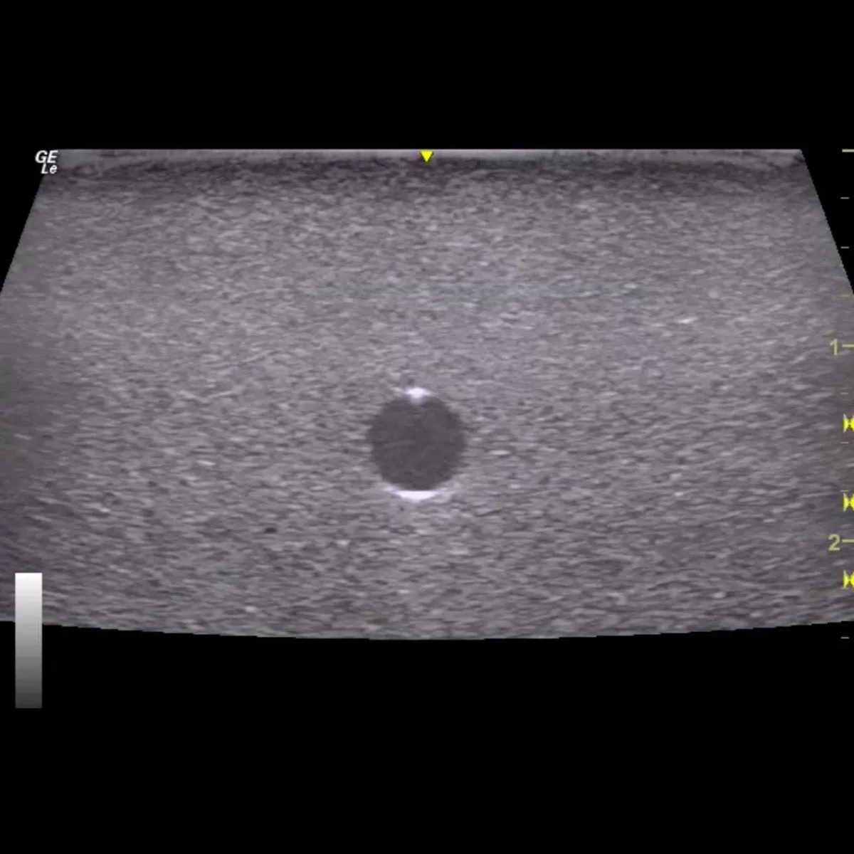 HM4.0 Reusable 4 Vessel Ultrasound Training Model
