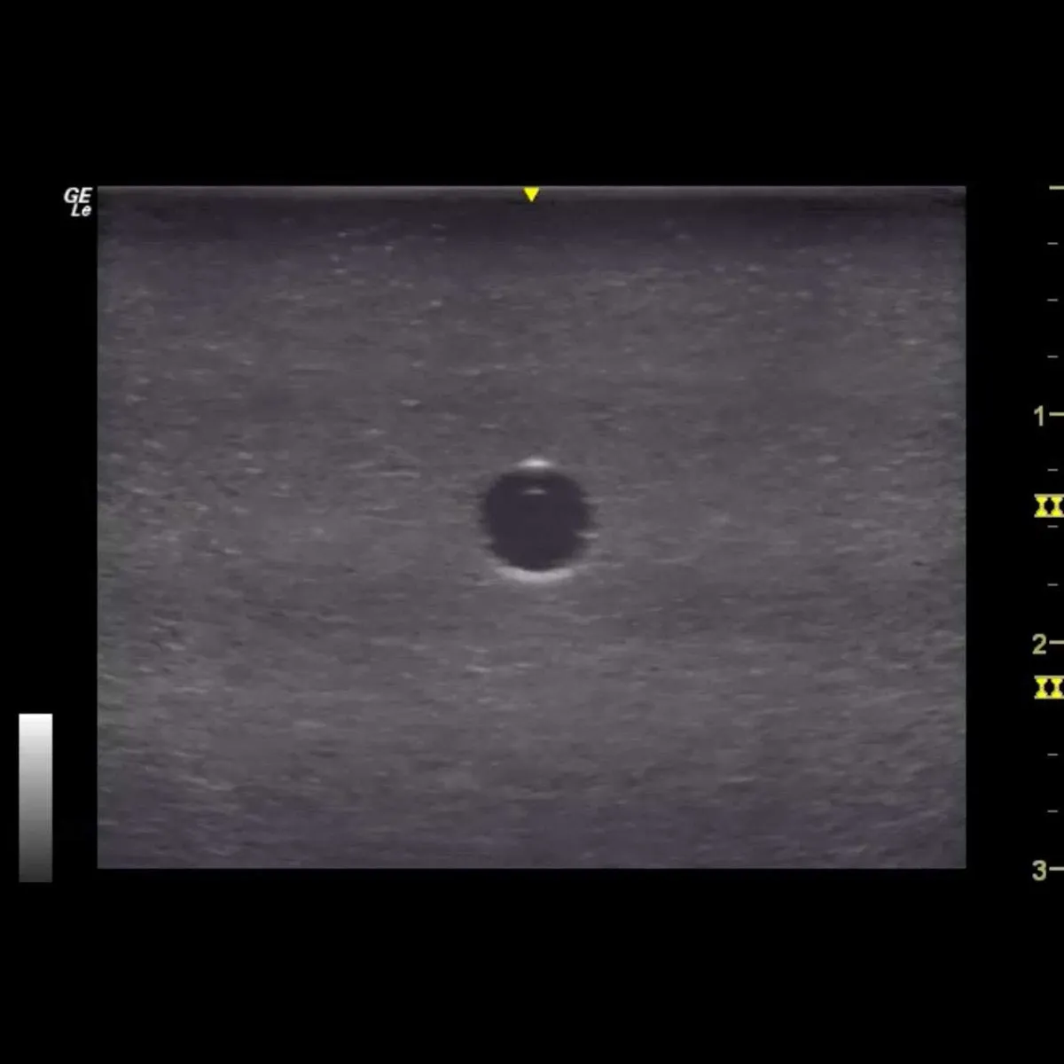 HM4.0 Reusable 4 Vessel Ultrasound Training Model
