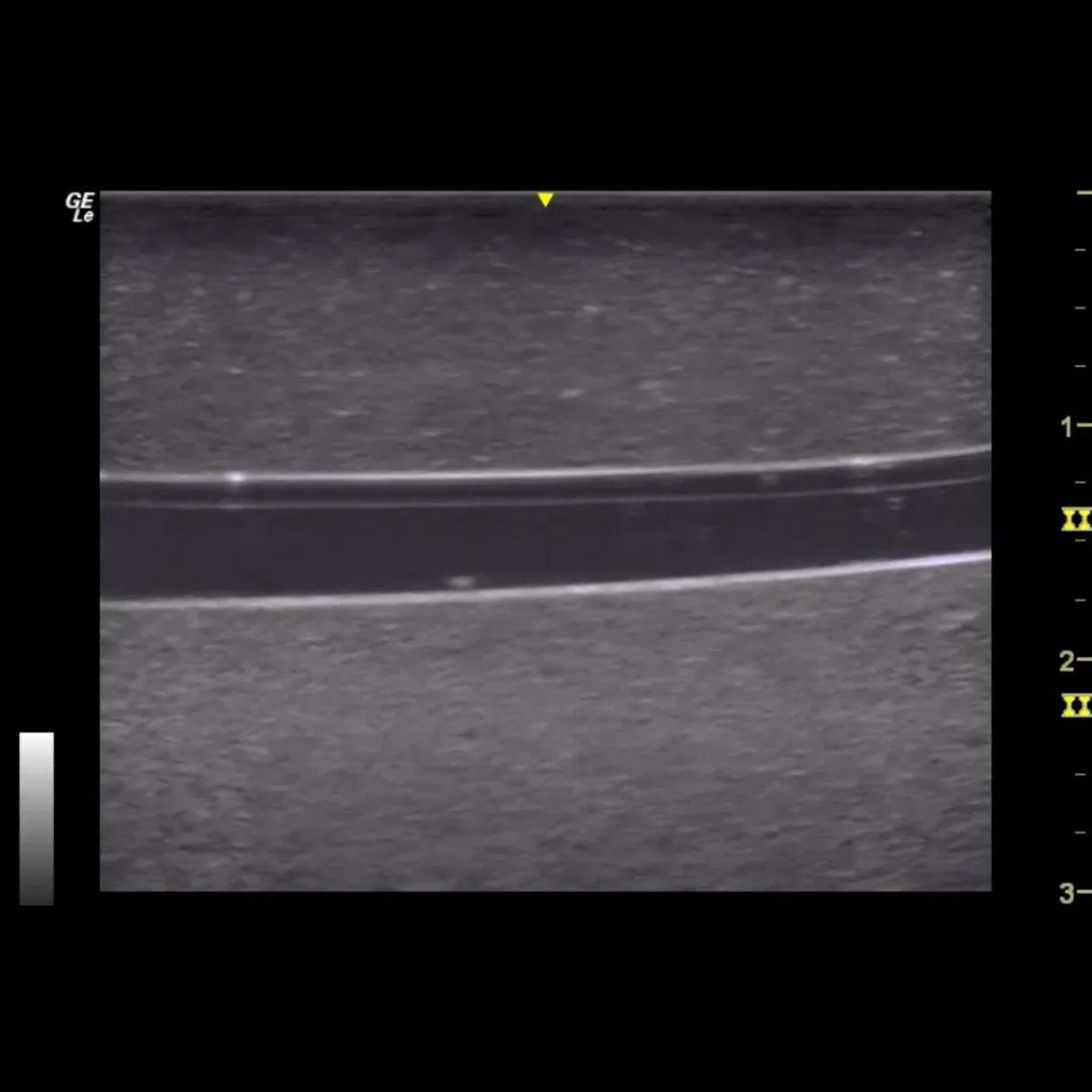 HM4.0 Reusable 4 Vessel Ultrasound Training Model