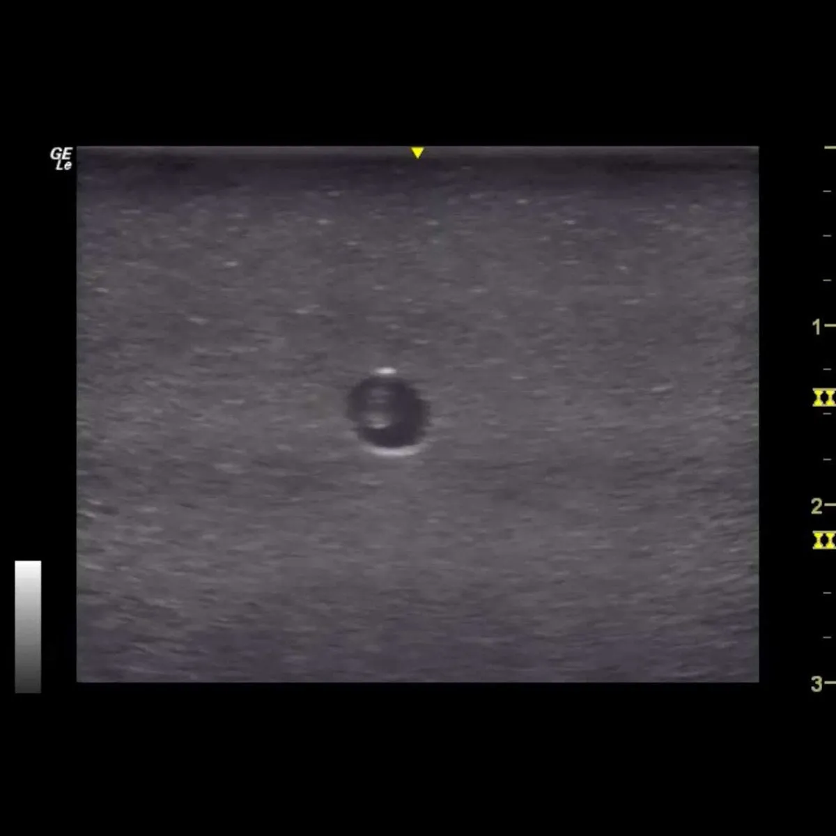 HM4.0 Reusable 4 Vessel Ultrasound Training Model