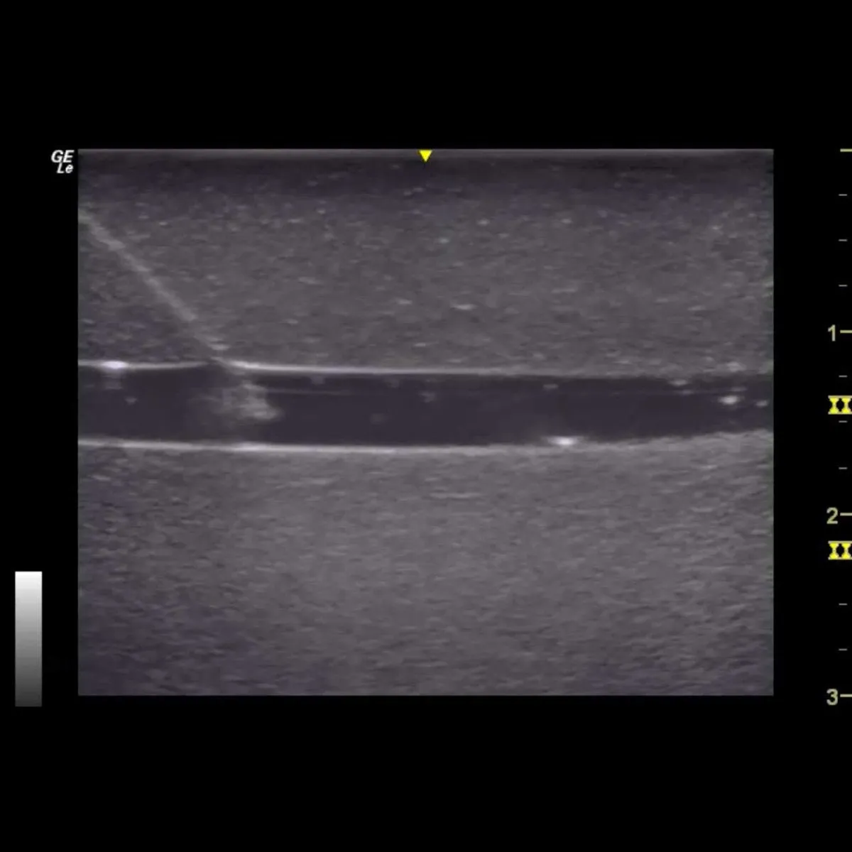 HM4.0 Reusable 4 Vessel Ultrasound Training Model